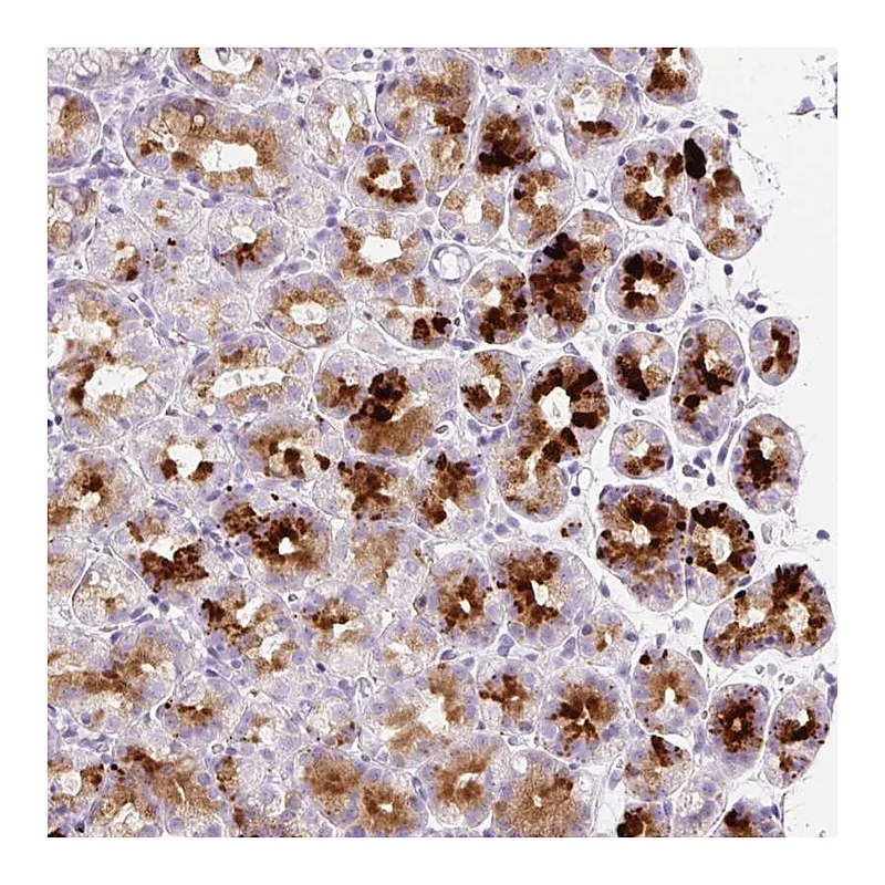 Atlas Antibodies Anti-SP140L Antibody