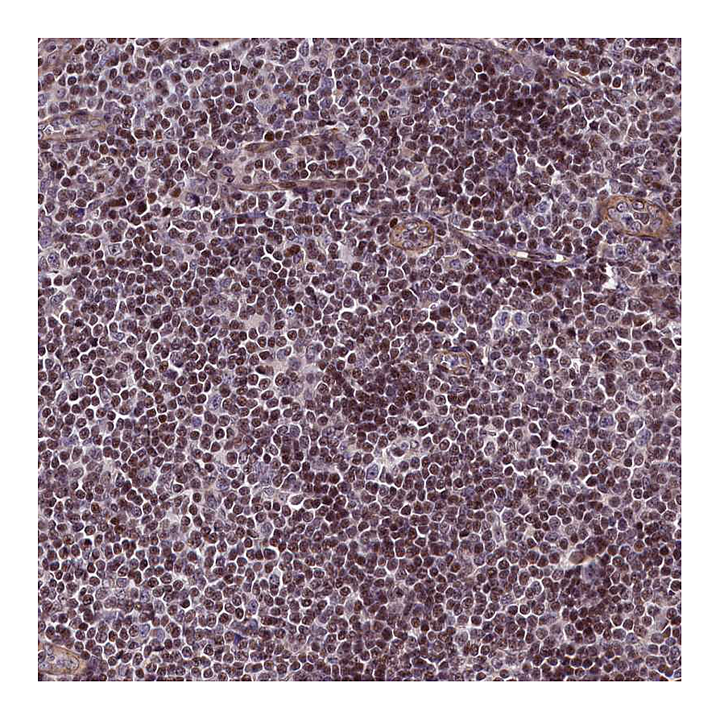 Atlas Antibodies Anti-SP4 Antibody