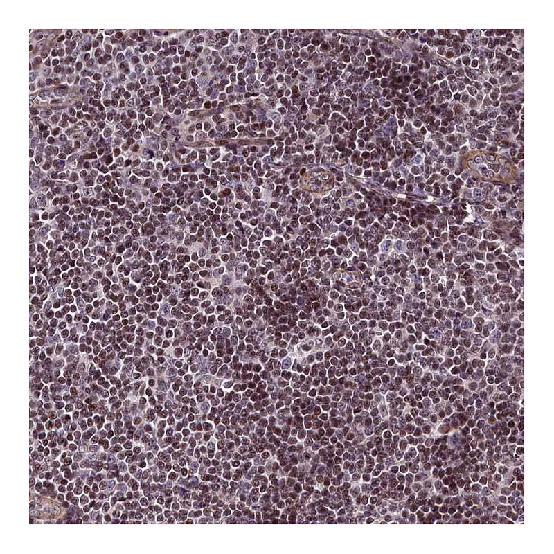Atlas Antibodies Anti-SP4 Antibody