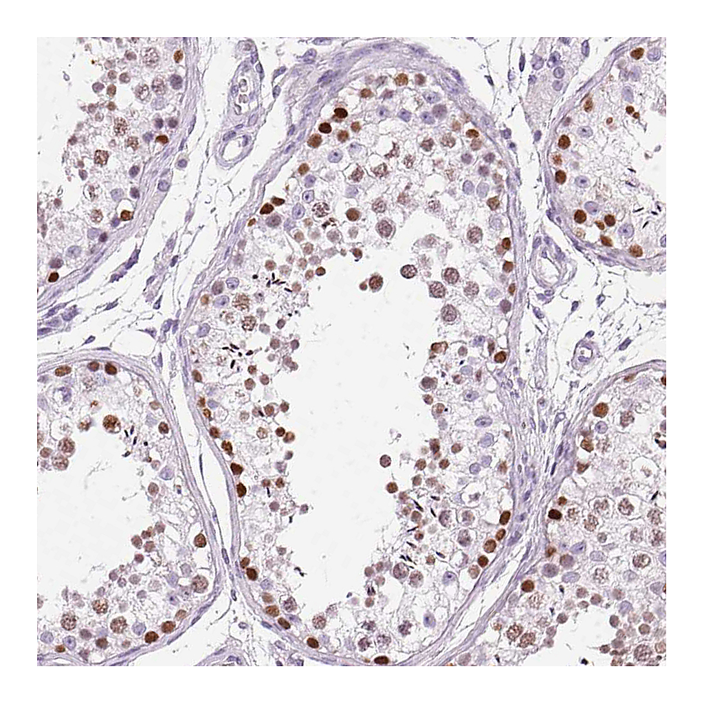 Atlas Antibodies Anti-SP7 Antibody