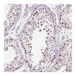 Atlas Antibodies Anti-SP7 Antibody