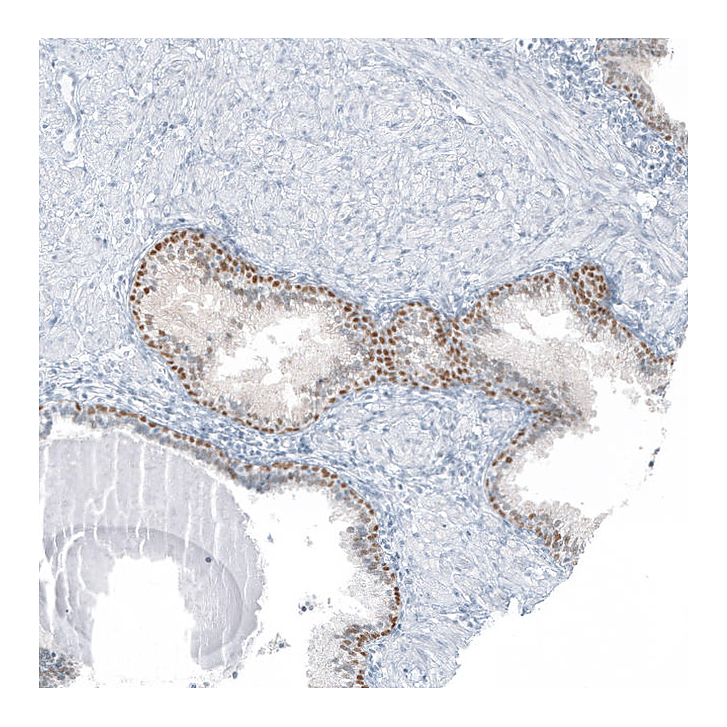Atlas Antibodies Anti-SP8 Antibody