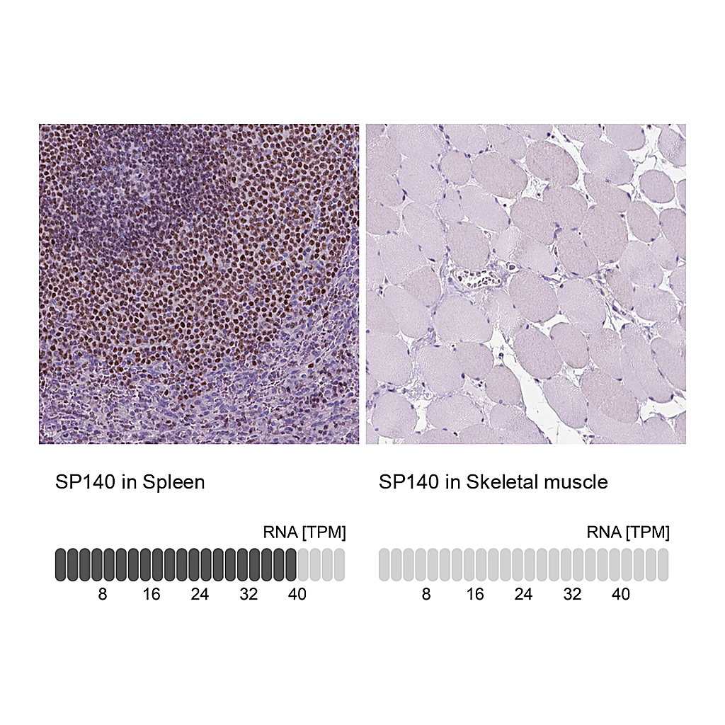 Atlas Antibodies Anti-SP140 Antibody