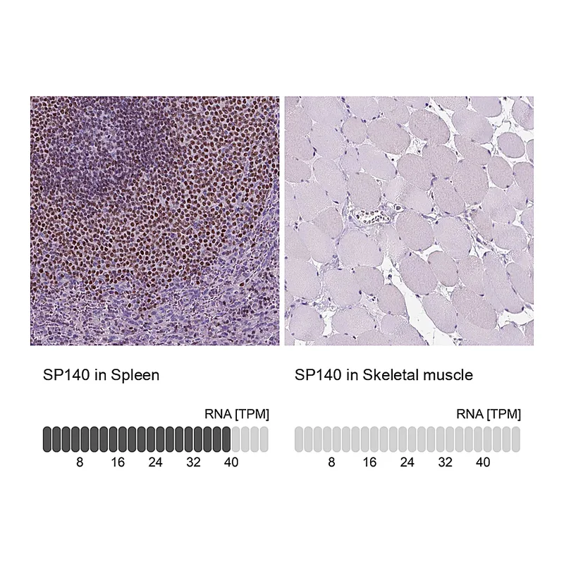 Atlas Antibodies Anti-SP140 Antibody