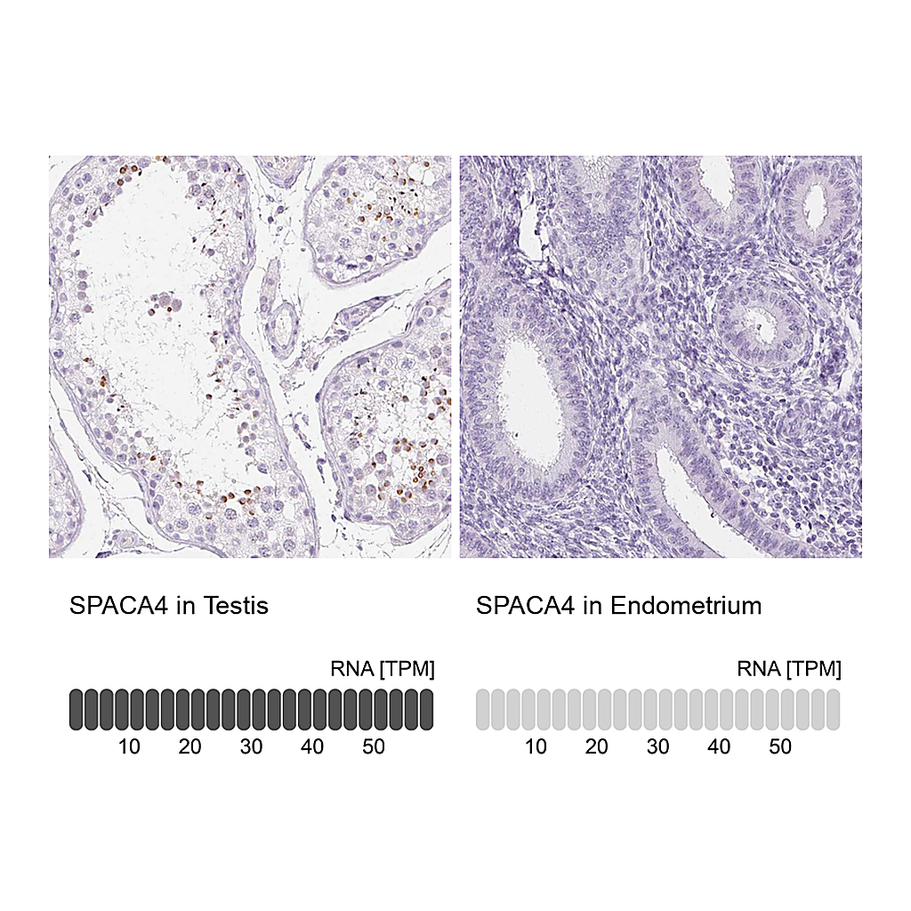 Atlas Antibodies Anti-SPACA4 Antibody
