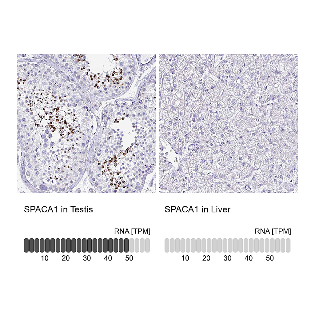 Atlas Antibodies Anti-SPACA1 Antibody