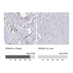 Atlas Antibodies Anti-SPACA1 Antibody