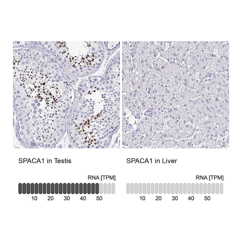 Atlas Antibodies Anti-SPACA1 Antibody