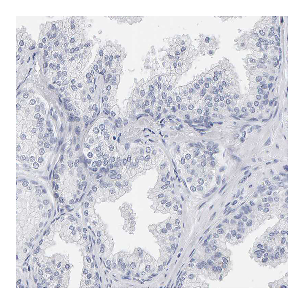 Atlas Antibodies Anti-SPACA3 Antibody