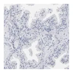 Atlas Antibodies Anti-SPACA3 Antibody