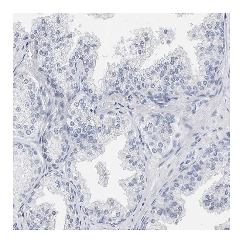 Atlas Antibodies Anti-SPACA3 Antibody