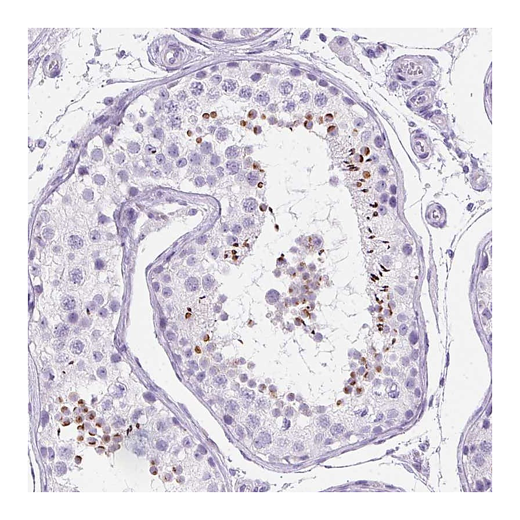 Atlas Antibodies Anti-SPACA5 Antibody