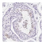 Atlas Antibodies Anti-SPACA5 Antibody