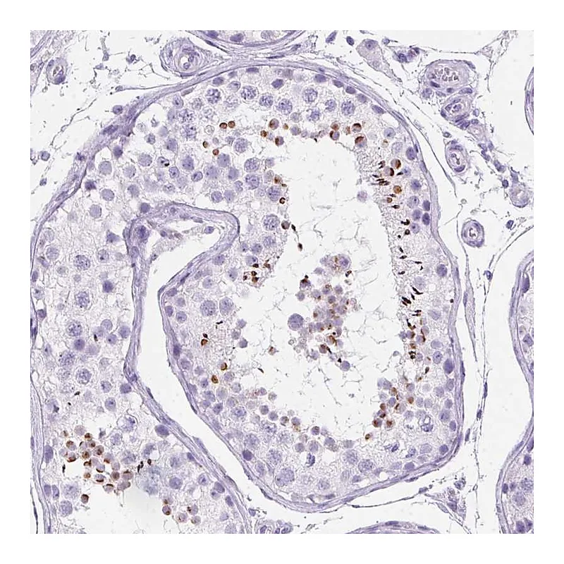 Atlas Antibodies Anti-SPACA5 Antibody