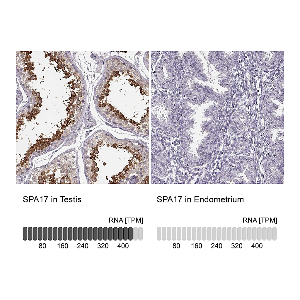 Atlas Antibodies Anti-SPA17 Antibody