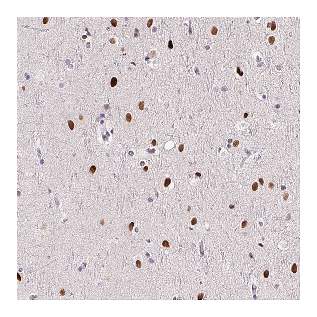 Atlas Antibodies Anti-SP9 Antibody