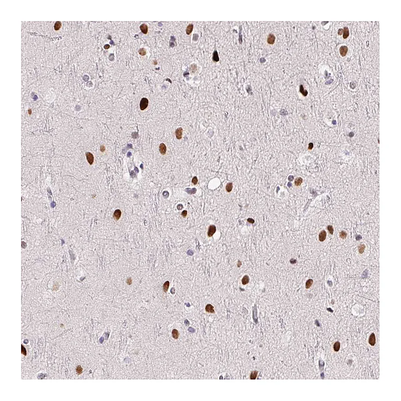 Atlas Antibodies Anti-SP9 Antibody