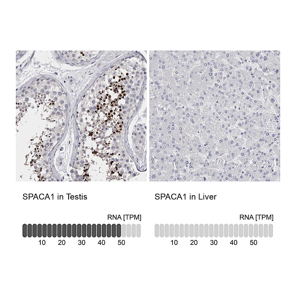 Atlas Antibodies Anti-SPACA1 Antibody