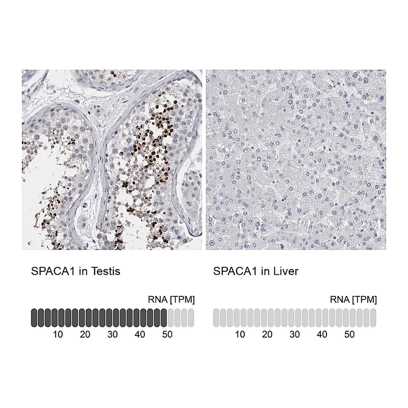 Atlas Antibodies Anti-SPACA1 Antibody