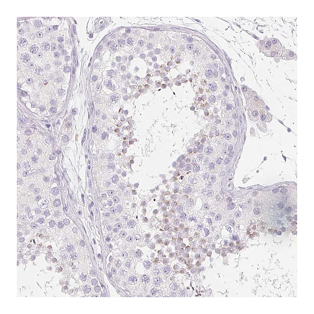 Atlas Antibodies Anti-SPACA5B Antibody