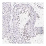 Atlas Antibodies Anti-SPACA5B Antibody