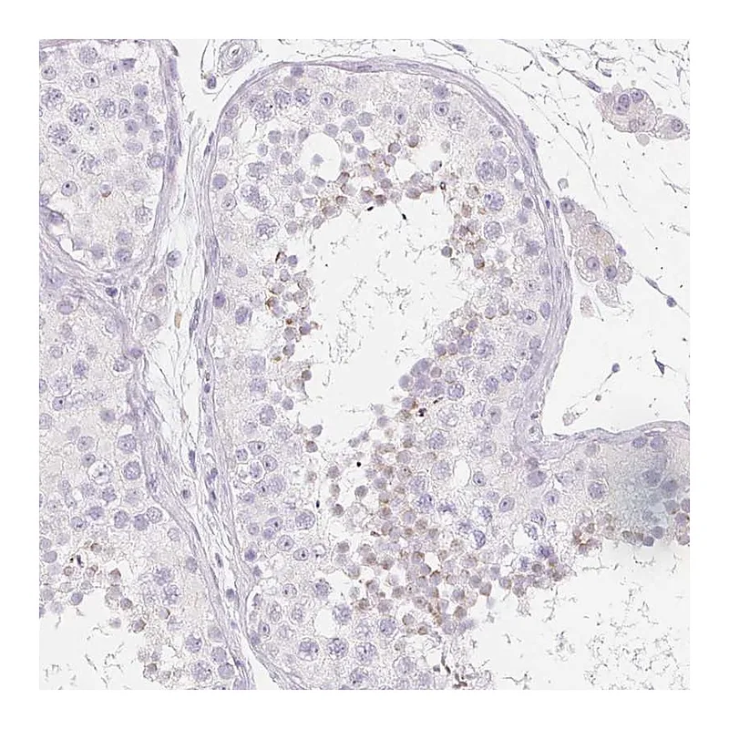 Atlas Antibodies Anti-SPACA5B Antibody