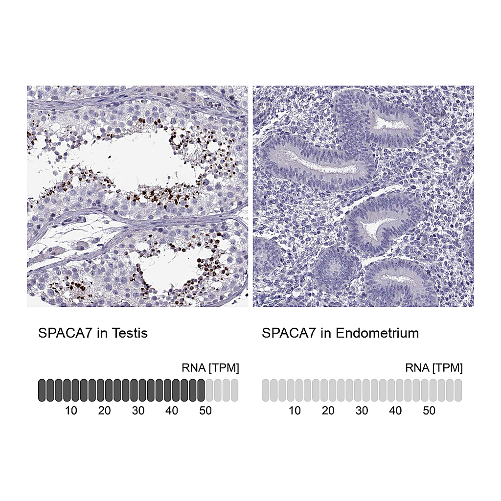 Atlas Antibodies Anti-SPACA7 Antibody