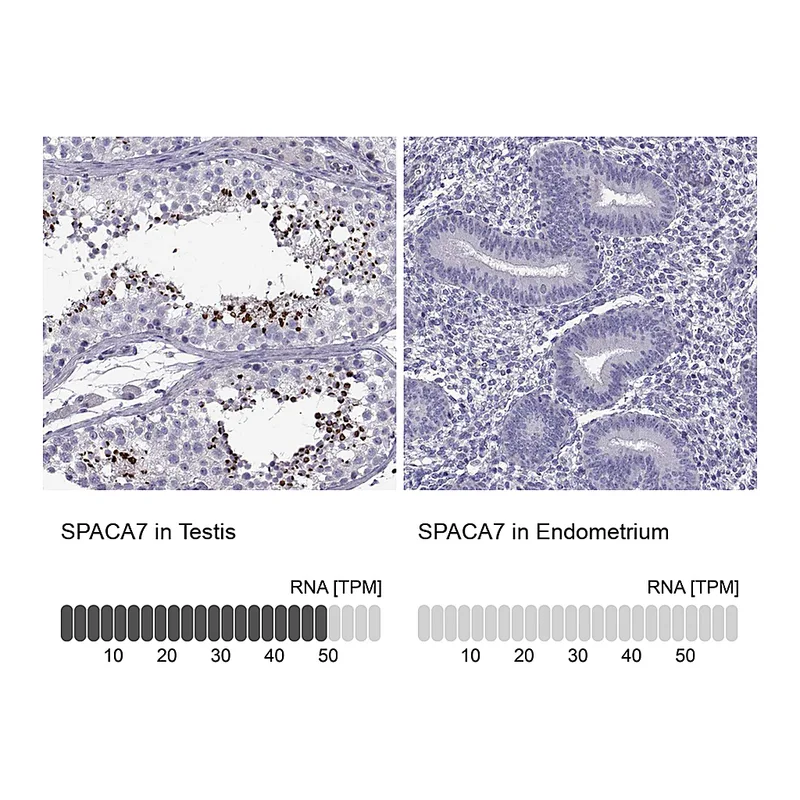 Atlas Antibodies Anti-SPACA7 Antibody