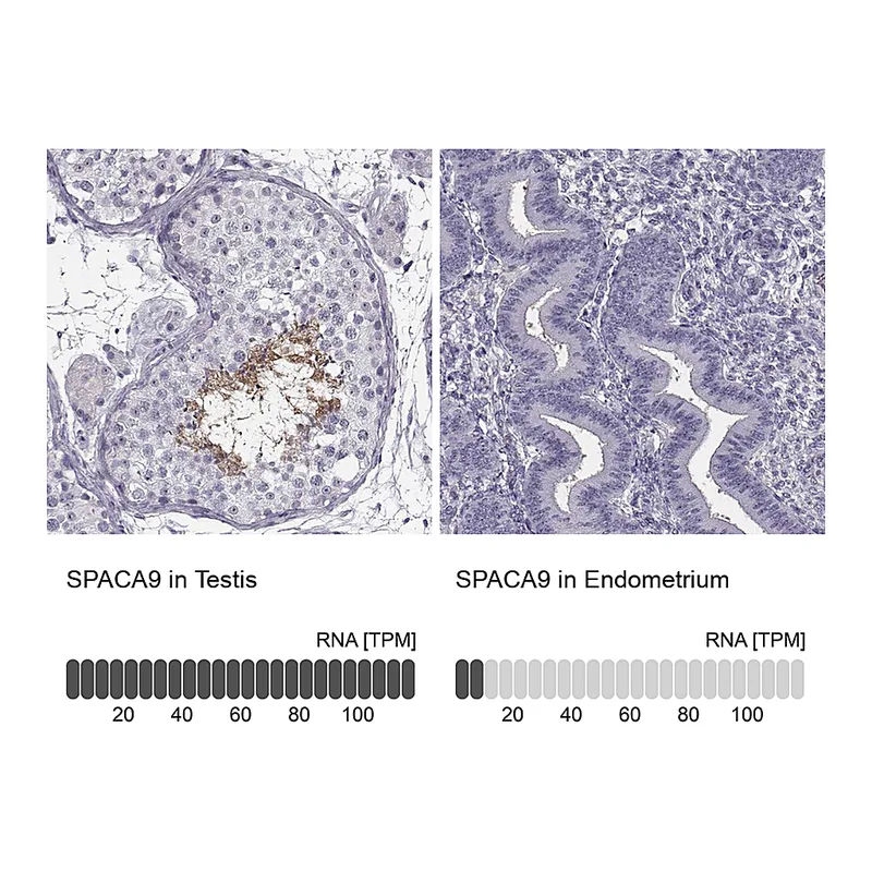 Atlas Antibodies Anti-SPACA9 Antibody
