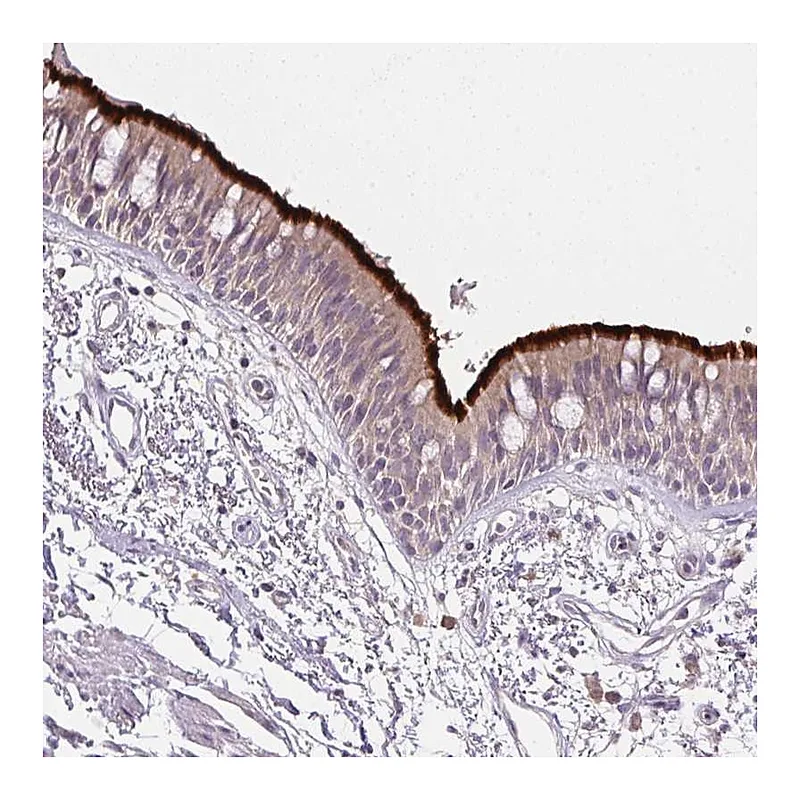 Atlas Antibodies Anti-SPACA9 Antibody