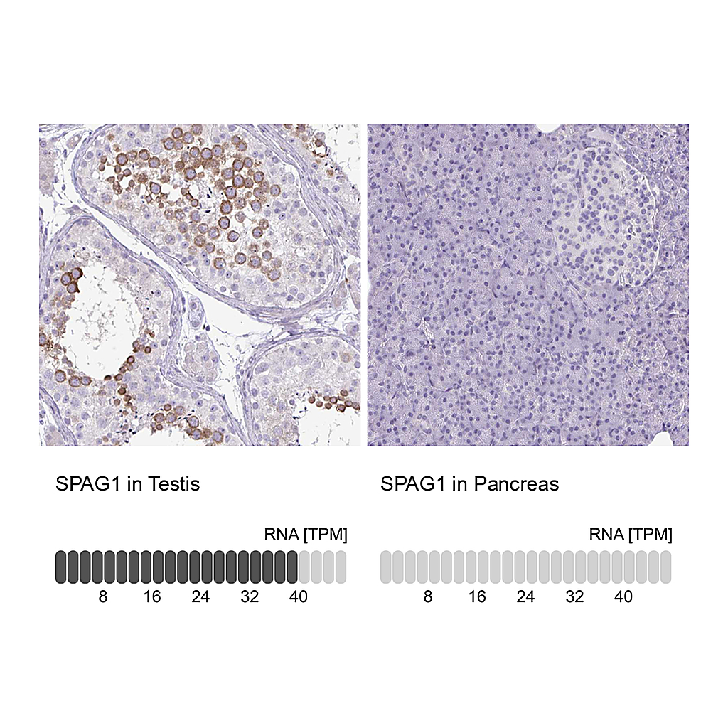 Atlas Antibodies Anti-SPAG1 Antibody