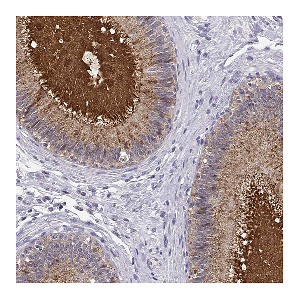 Atlas Antibodies Anti-SPAG11B Antibody