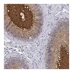 Atlas Antibodies Anti-SPAG11B Antibody