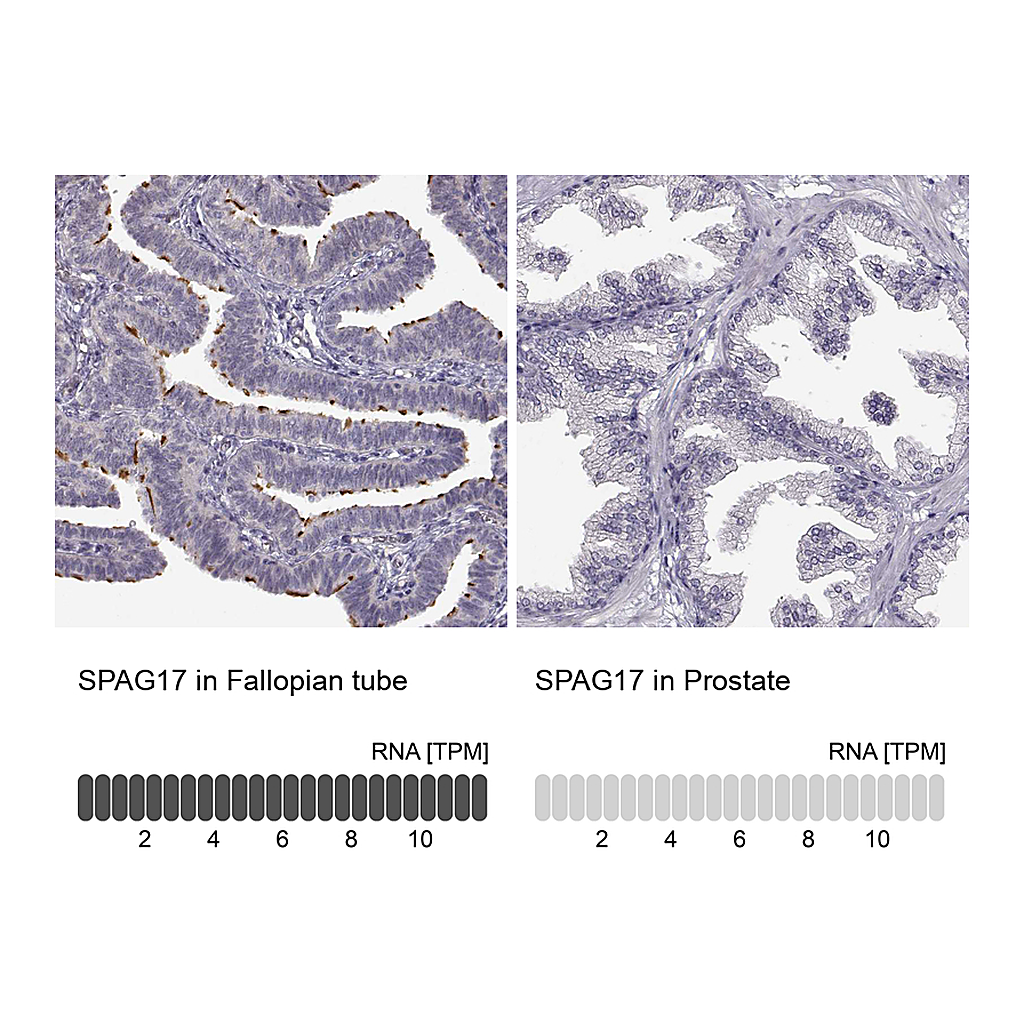 Atlas Antibodies Anti-SPAG17 Antibody