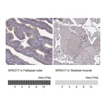 Atlas Antibodies Anti-SPAG17 Antibody