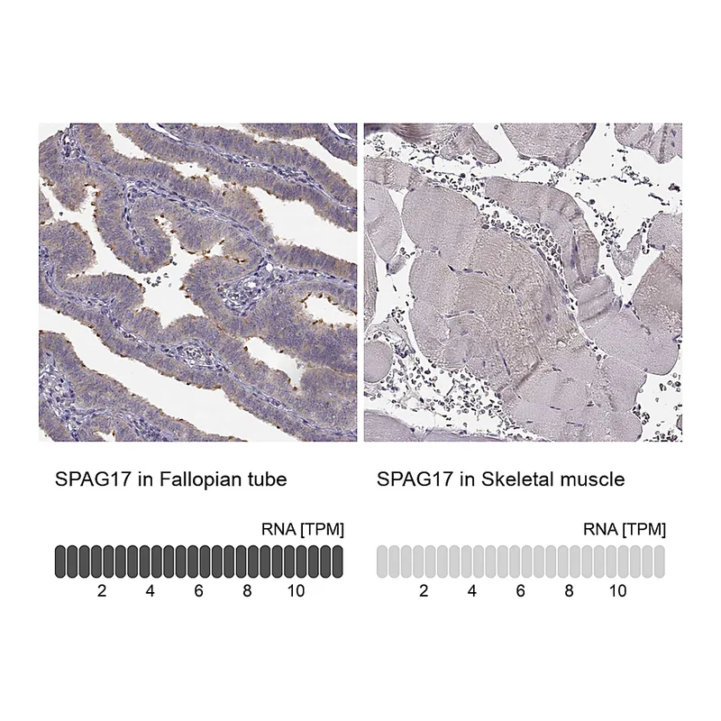 Atlas Antibodies Anti-SPAG17 Antibody