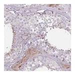 Atlas Antibodies Anti-SPAG4 Antibody