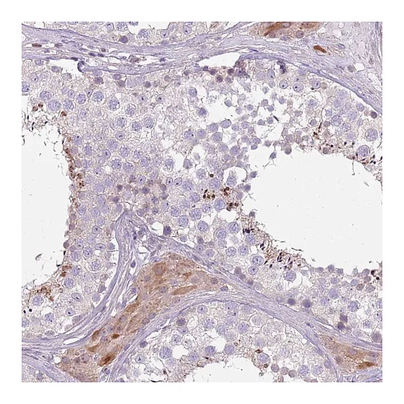 Atlas Antibodies Anti-SPAG4 Antibody