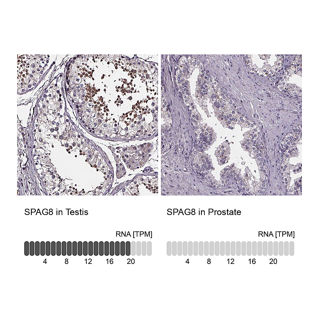 Atlas Antibodies Anti-SPAG8 Antibody