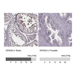 Atlas Antibodies Anti-SPAG8 Antibody