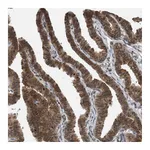 Atlas Antibodies Anti-SPAG7 Antibody