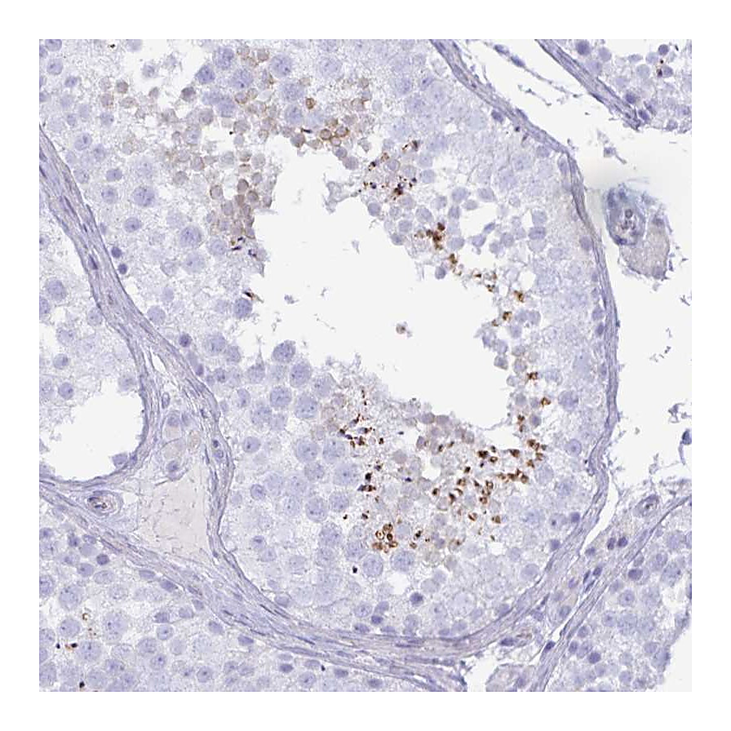 Atlas Antibodies Anti-SPAG4 Antibody