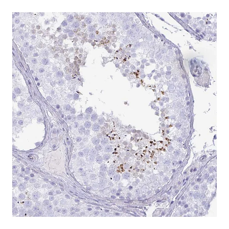 Atlas Antibodies Anti-SPAG4 Antibody