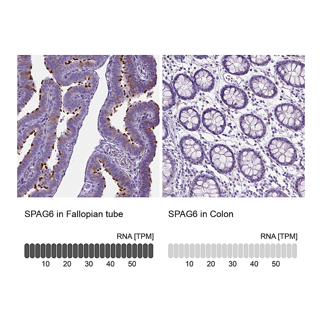 Atlas Antibodies Anti-SPAG6 Antibody