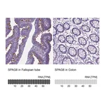 Atlas Antibodies Anti-SPAG6 Antibody