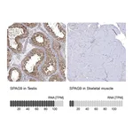 Atlas Antibodies Anti-SPAG9 Antibody