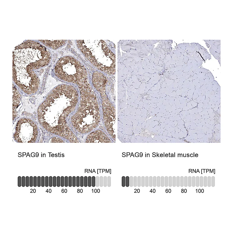 Atlas Antibodies Anti-SPAG9 Antibody