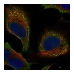 Atlas Antibodies Anti-SPANXN4 Antibody