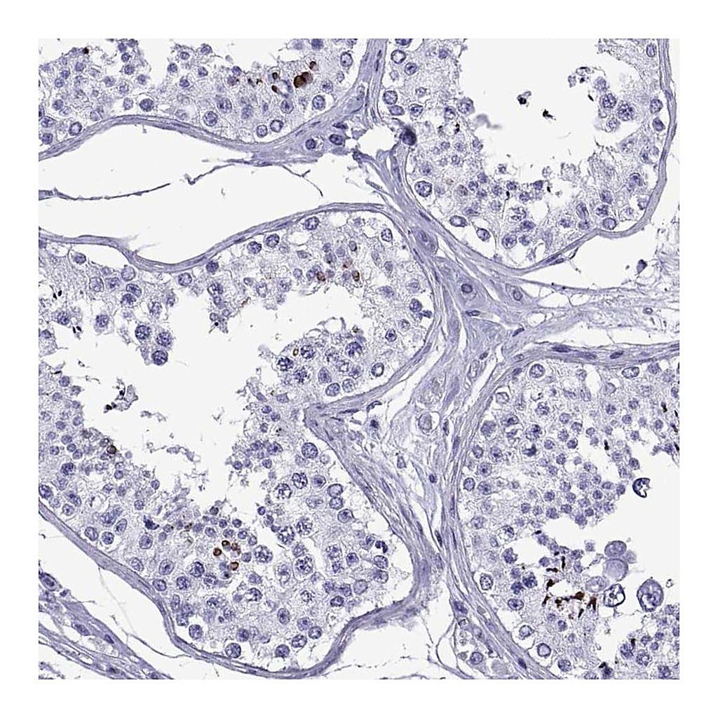 Atlas Antibodies Anti-SPANXC Antibody