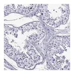 Atlas Antibodies Anti-SPANXC Antibody